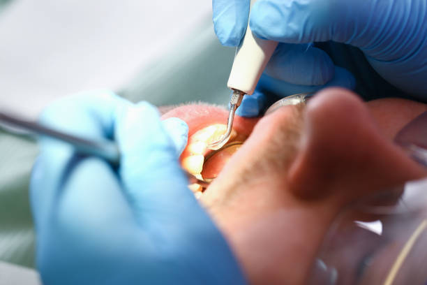 Best Same-Day Emergency Dental Services in Creve Coeur, IL
