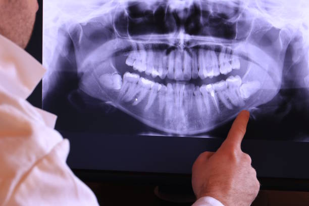 Best Weekend Emergency Dentist in Creve Coeur, IL