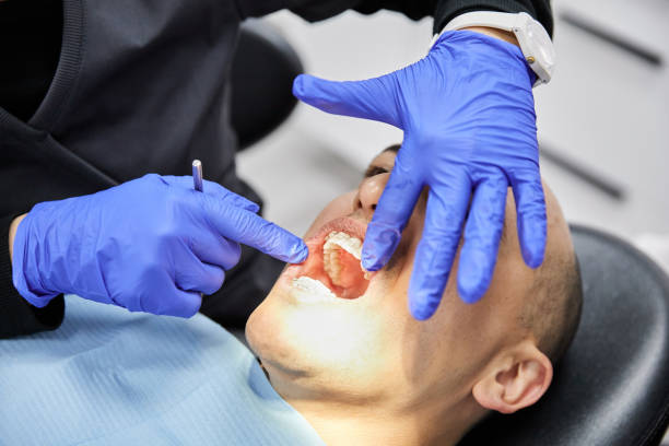 Best Emergency Tooth Extraction in Creve Coeur, IL