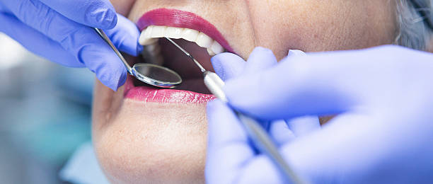 Best Cosmetic Emergency Dentistry in Creve Coeur, IL